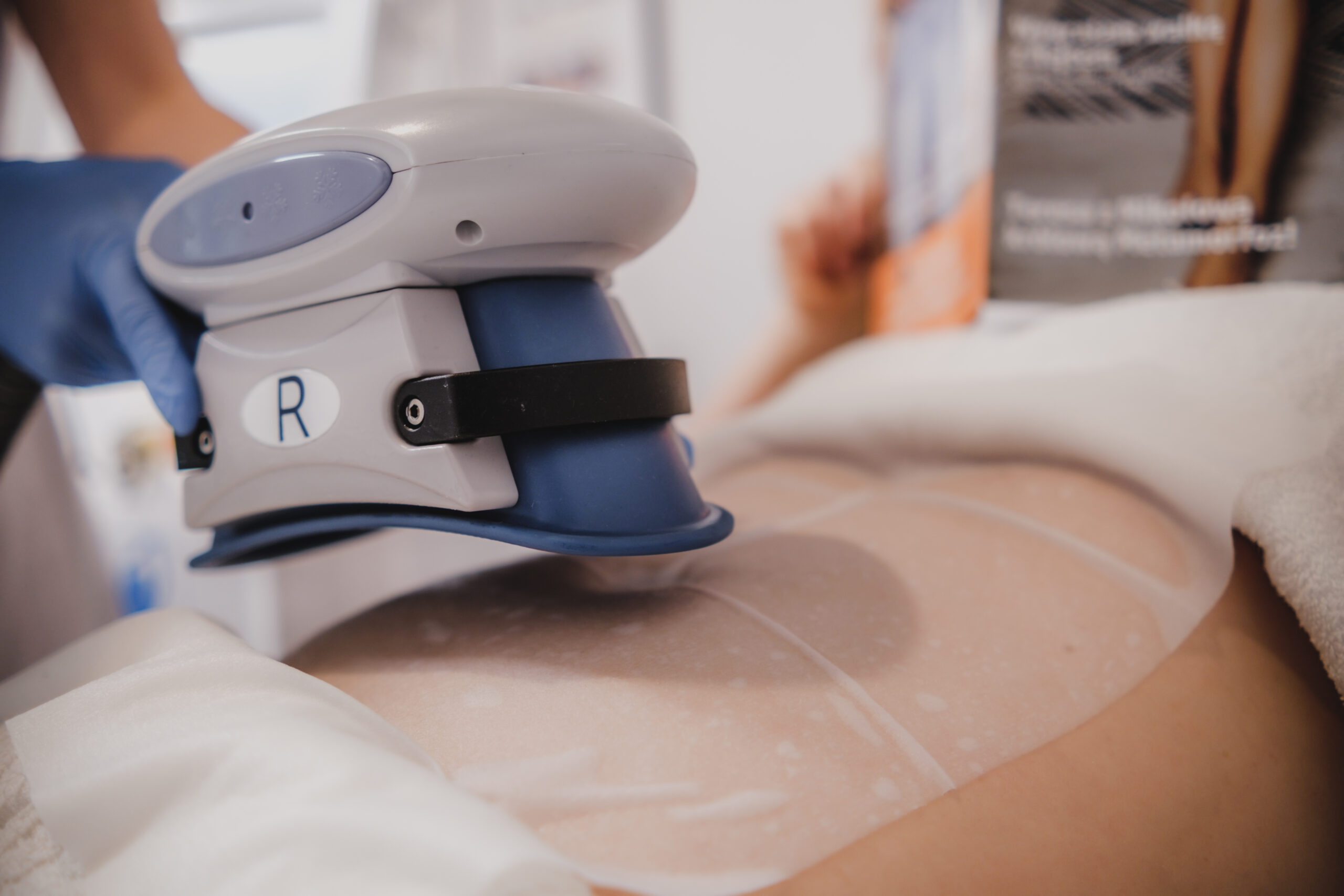 Kriolipoliza Ząbkowice Śląskie Kriolipoliza Ząbkowice Śląskie